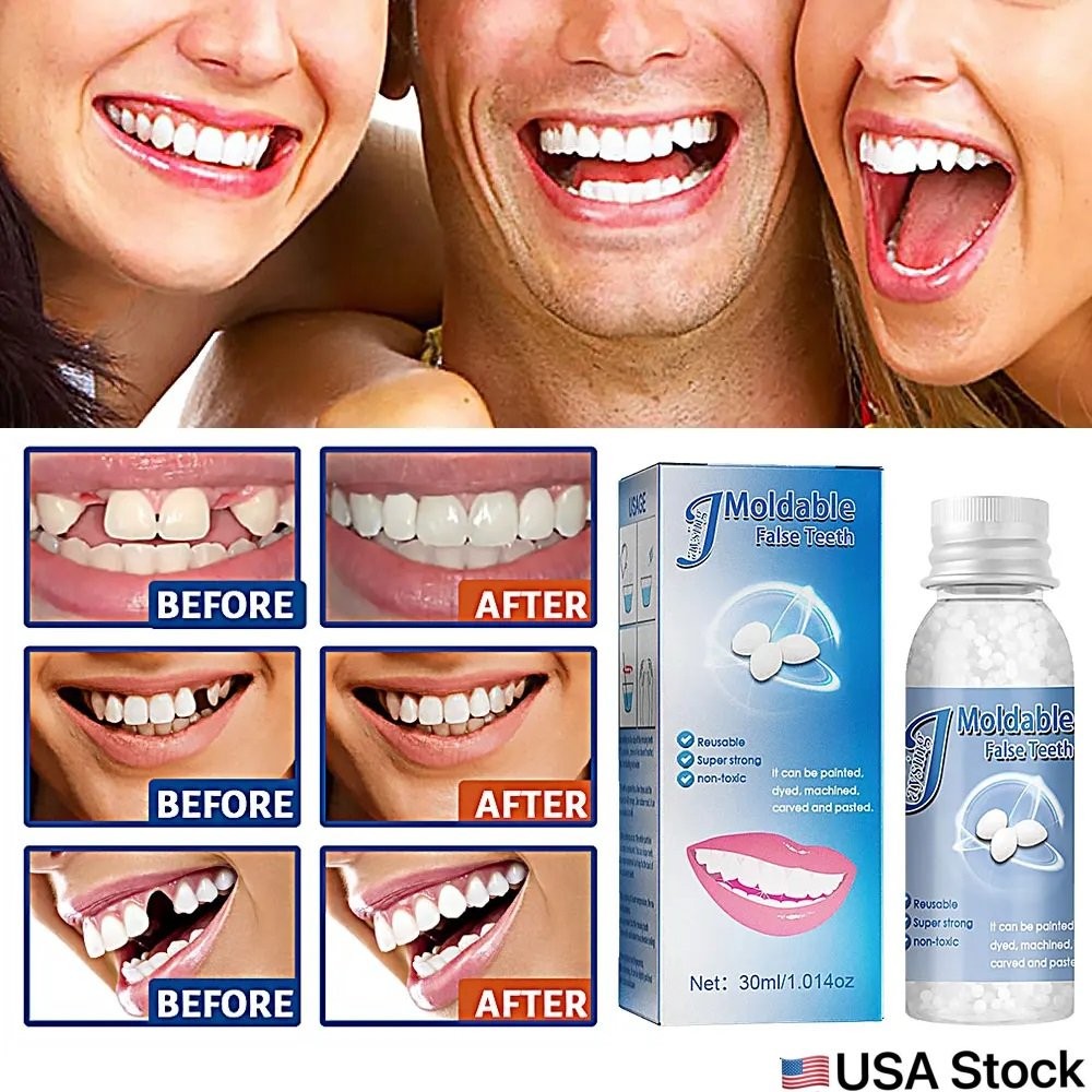 Resin False Teeth Solid Glue Temporary Tooth Gap Filler Tooth Repair Moldable US
