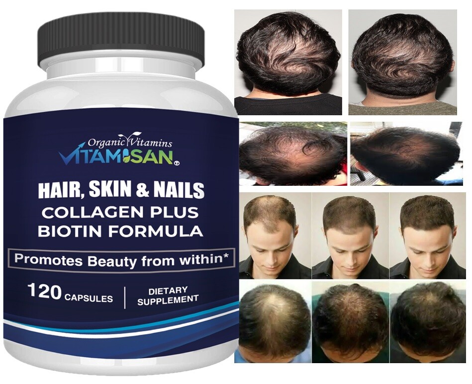 BIOTIN PLUS 12 CAP MAXIMUM COLAGEN HAIR GROWTH SMOOTH SKIN STRONG NAILS VITAMIN