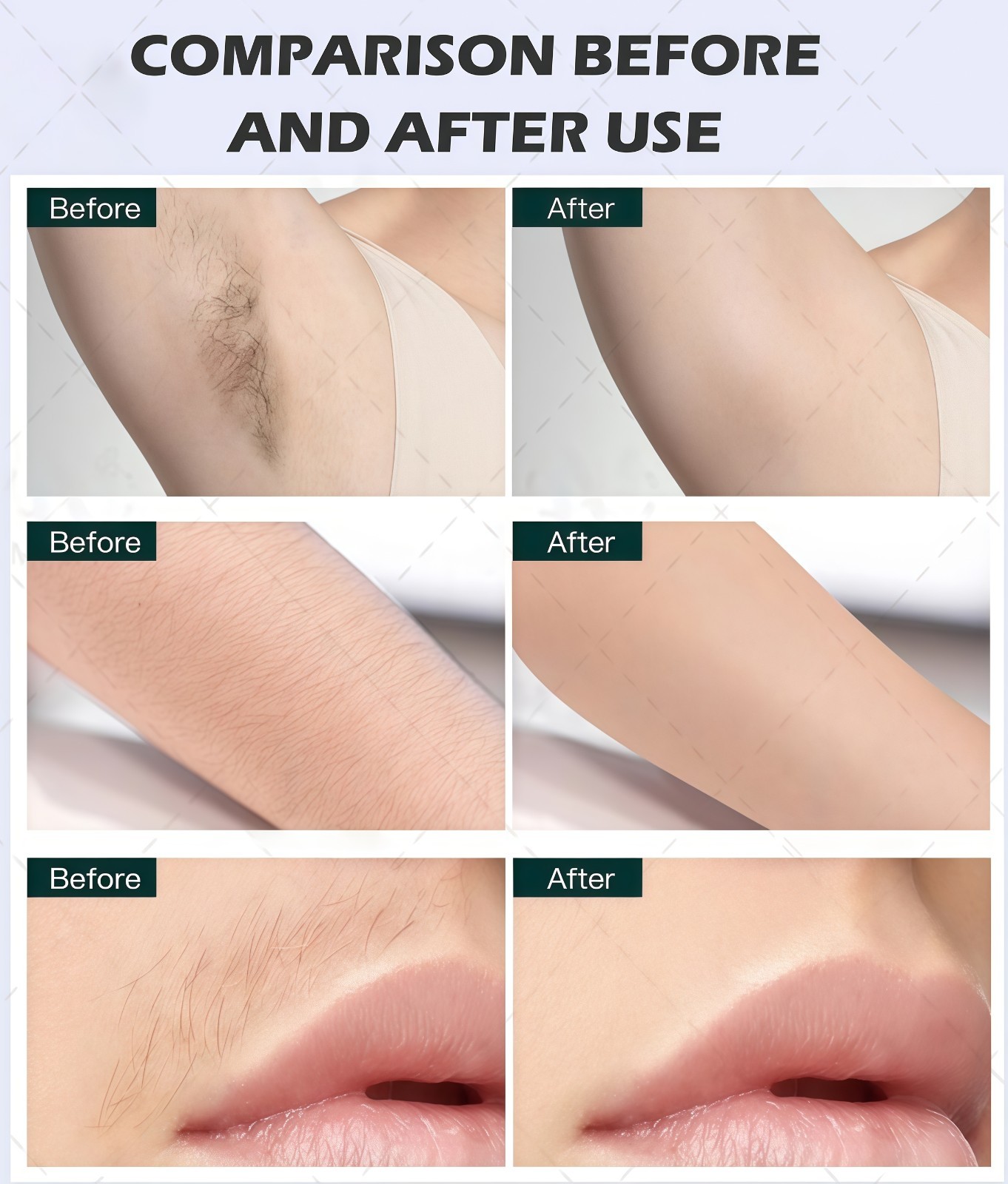 2 In1 Diode Laser Hair Removal & ND Yag Pico Laser Tattoo Removal Skin Care