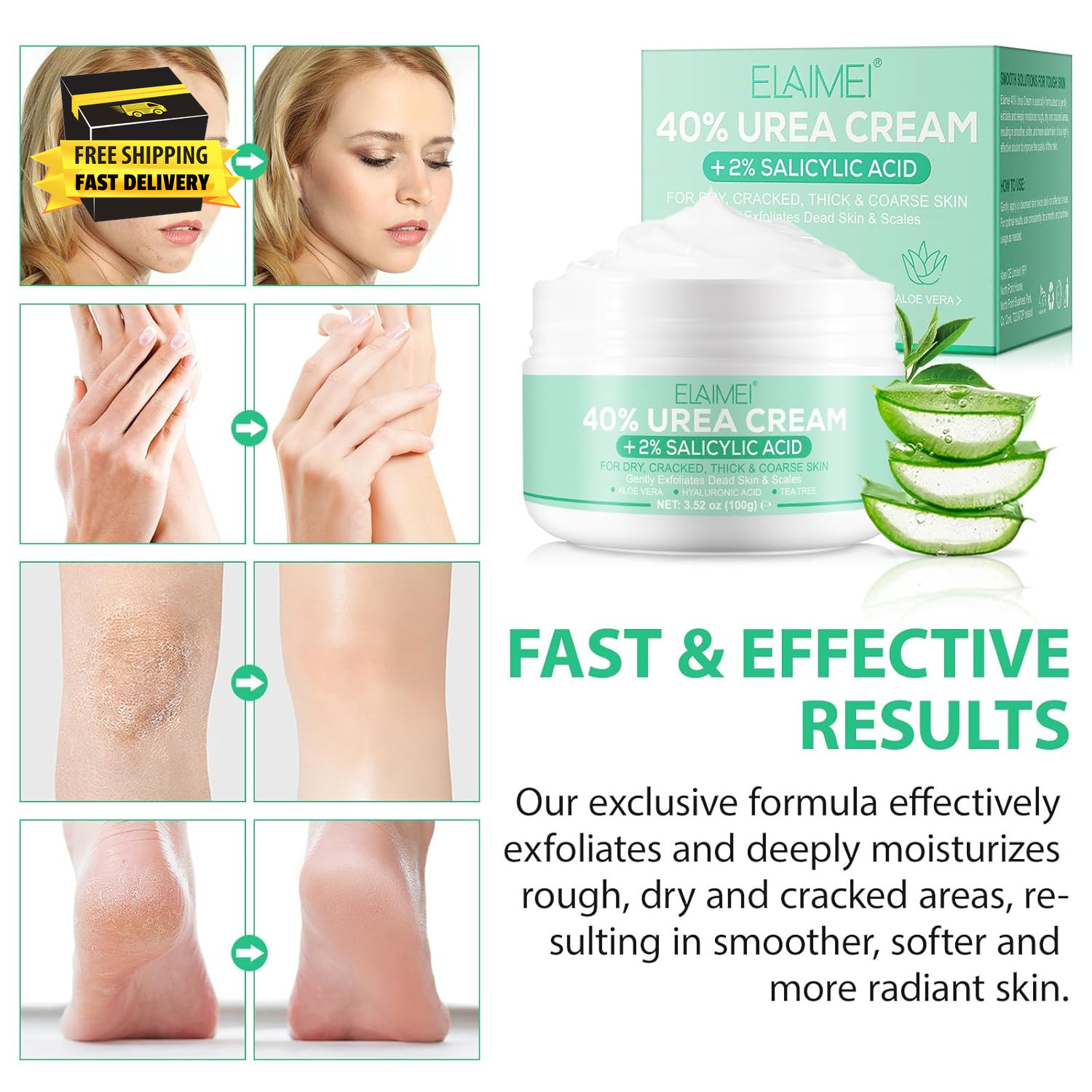 Urea Cream 40 Percent for Feet Maximum Strength-Urea Foot Cream 40% for Dry Crac