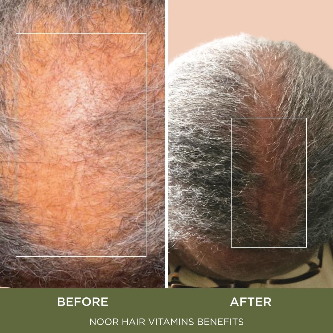 NOOR HAIR Healthy Hair Formula, Hair Growth Supplement Supporting Thick Hair