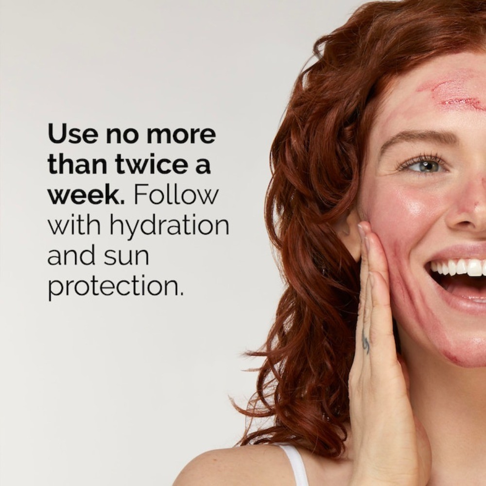 The Ordinary Authentic High-Strength Peeling Solution 1 oz / 30 mL