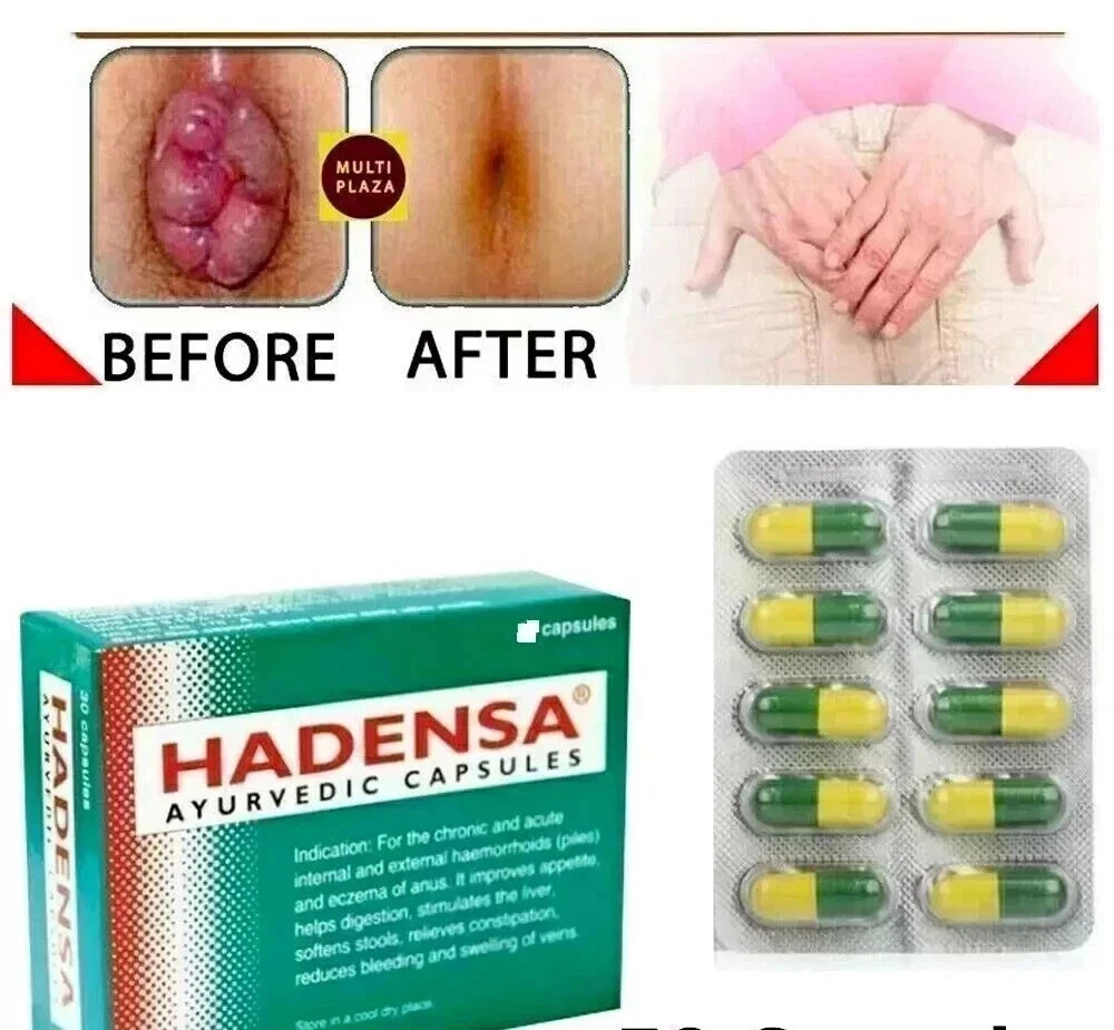 Hadensa Ayurvedic 50 Capsules – Stop Hemorrhoids & Piles Pain Relief Capsules