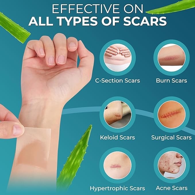 Scar Removal Silicone Tape for Hypertrophic Scars & Keloids, 1.6” x 150”