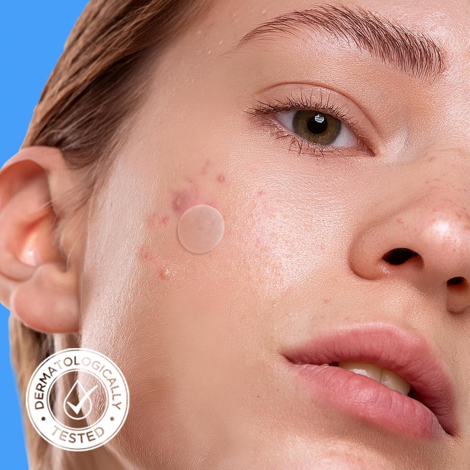Dermatologist-Approved Hydrocolloid Pimple Patches – 300 Count for Blemish Care