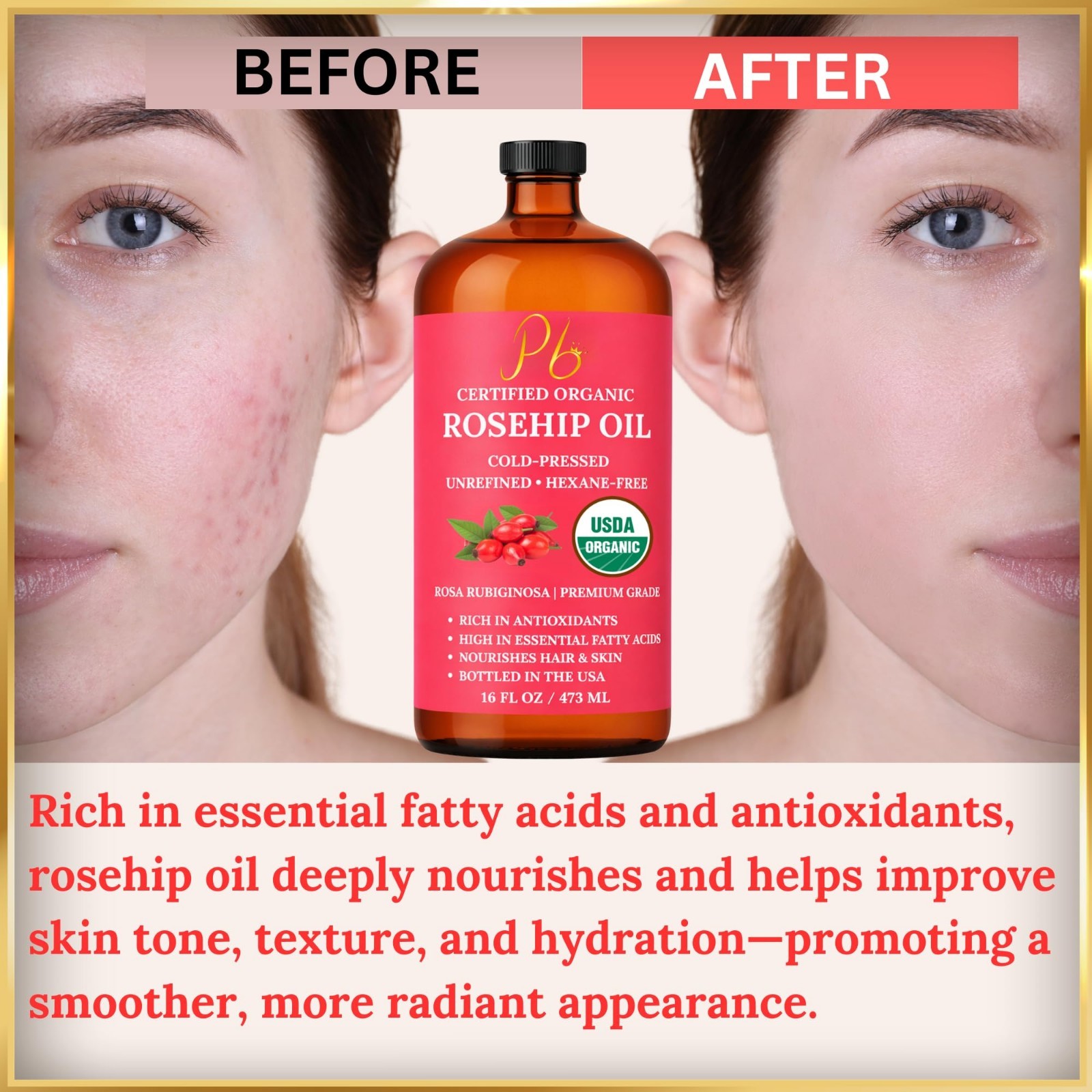 Organic Rosehip Oil 100% Pure Cold-Pressed Unrefined for Face Skin Hair 16 fl oz