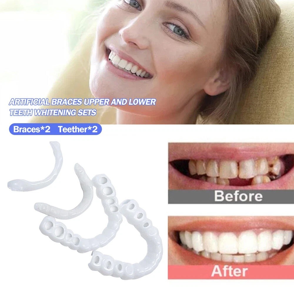 Smile Snap On Upper + Lower False Teeth Dental Veneers Denture Tooth Cover Set