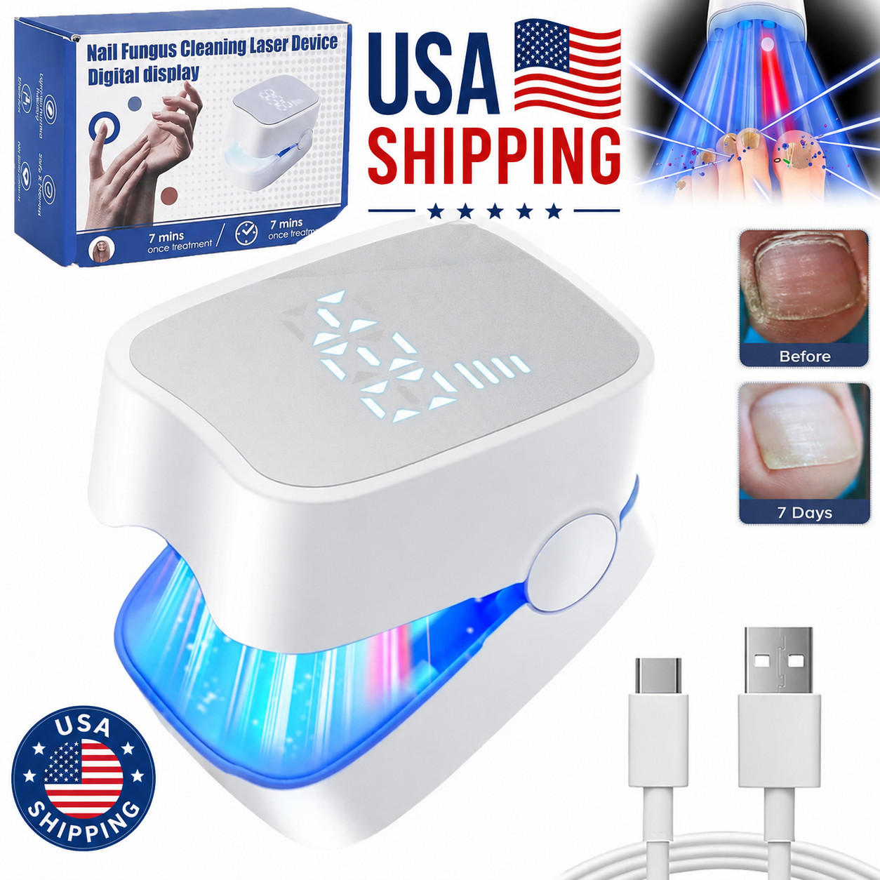 Nail Fungus Laser Treatment Device Toenail Fungus Remover Onychomycosis Care