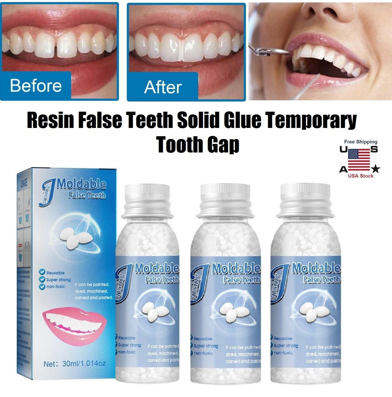 Resin False Teeth Solid Glue Temporary Tooth Gap Filler Tooth Repair Moldable