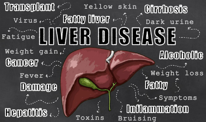 liver detoxifier – LIVER SUPPORT COMPLEX 1200mg – beef liver powder 60 Capsules