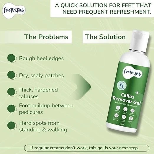 Footvital Callus Remover Gel with 20% Urea & Tea Tree Oil–100ml Clinically Test