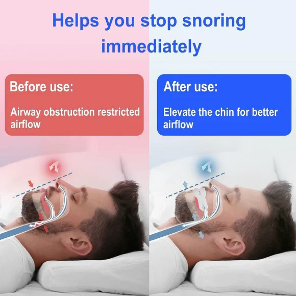 Adjustable Anti Snoring Mouthpiece Custom Fit Sleep Aid Mouth Guard for Adults