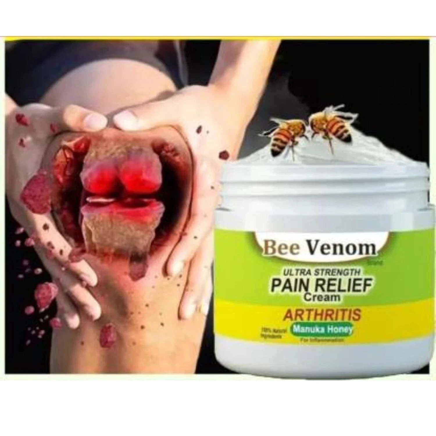 Bee Venom Therapy Nature’s Answer to Pain Relief 100ml pack of 2