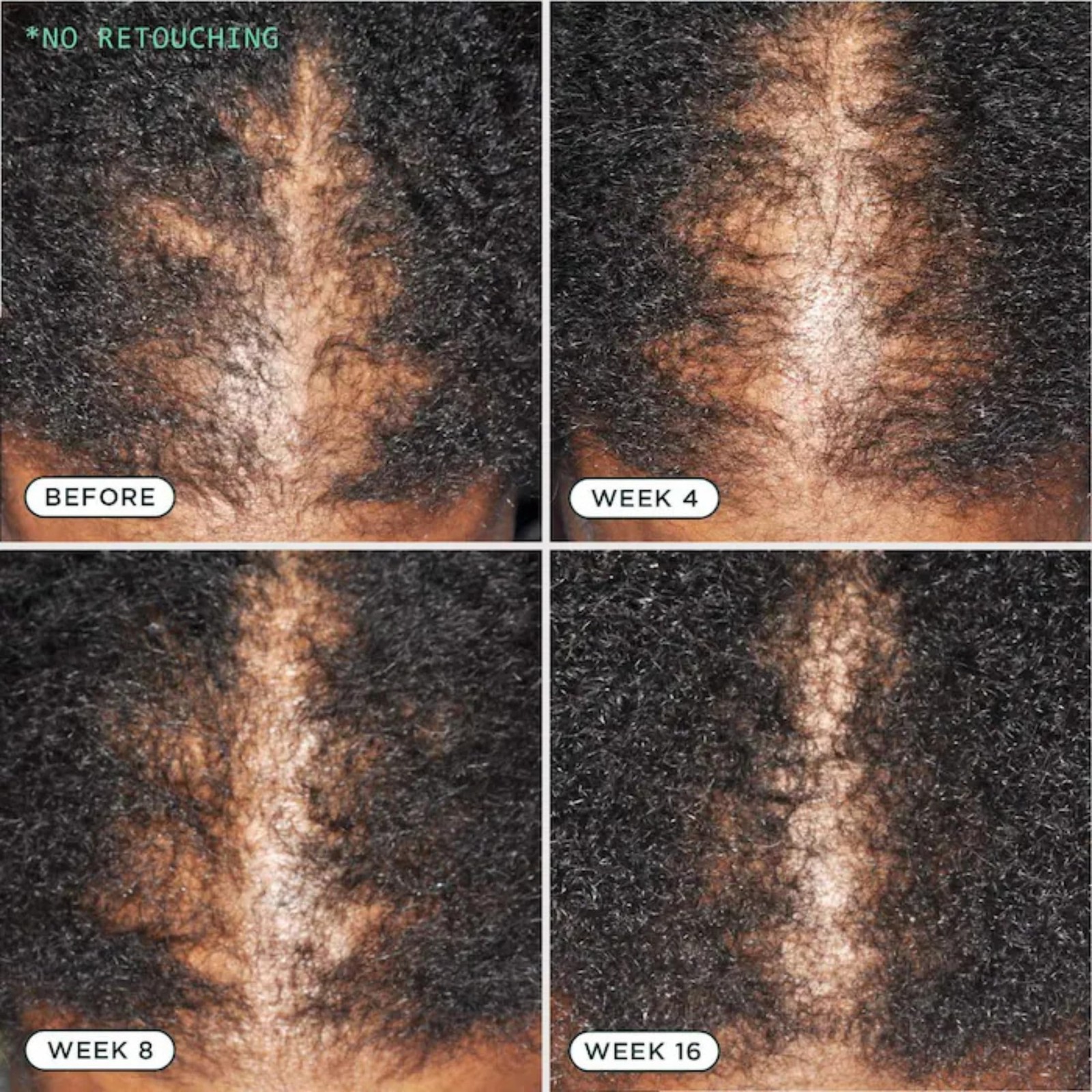 – D.N.A. Scalp – Hair Growth for Thinning Hair, Scalp Repair & Strength – Nou…