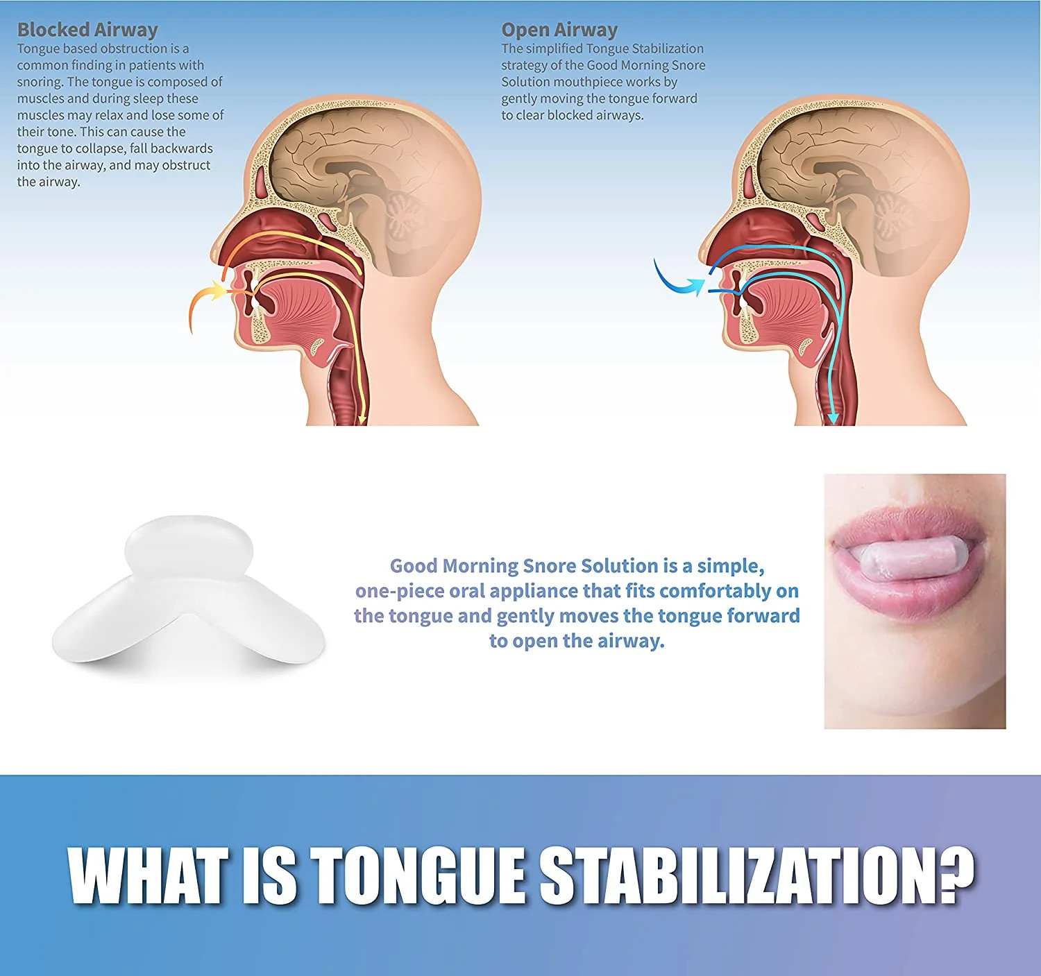 Good Morning Snore Solution® Mouthpiece – FDA CLEARED