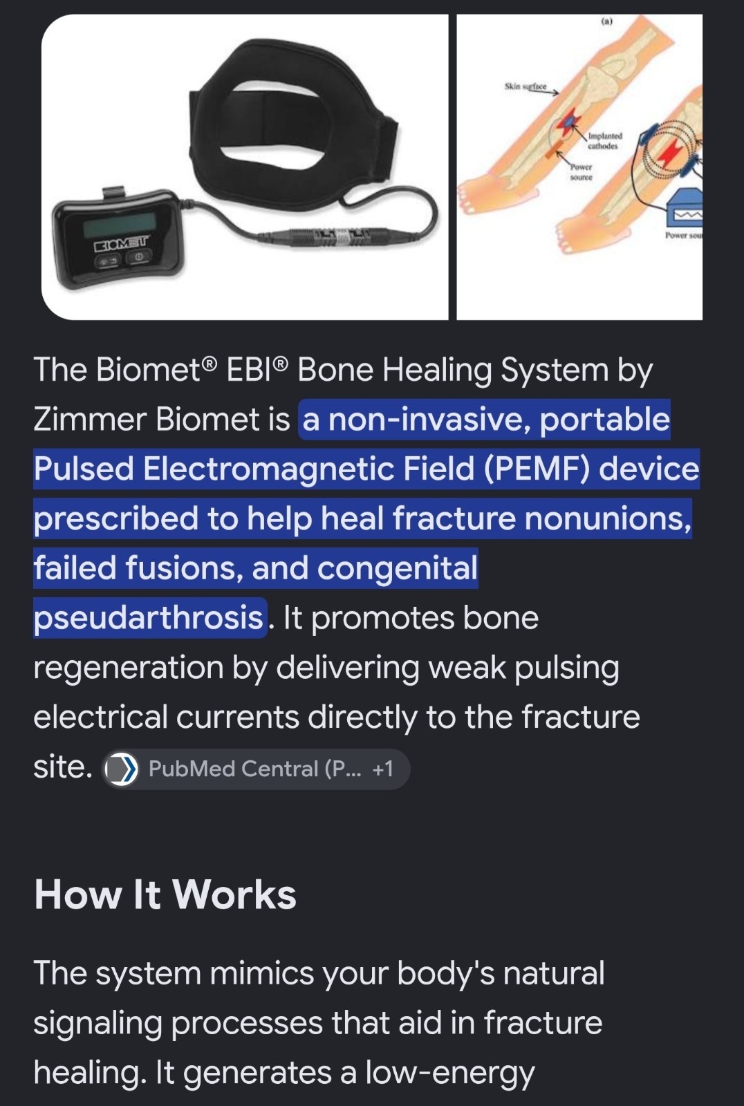 Biomet Ebi Bone Healing System Model 2001 With Accessories Manuels, Case