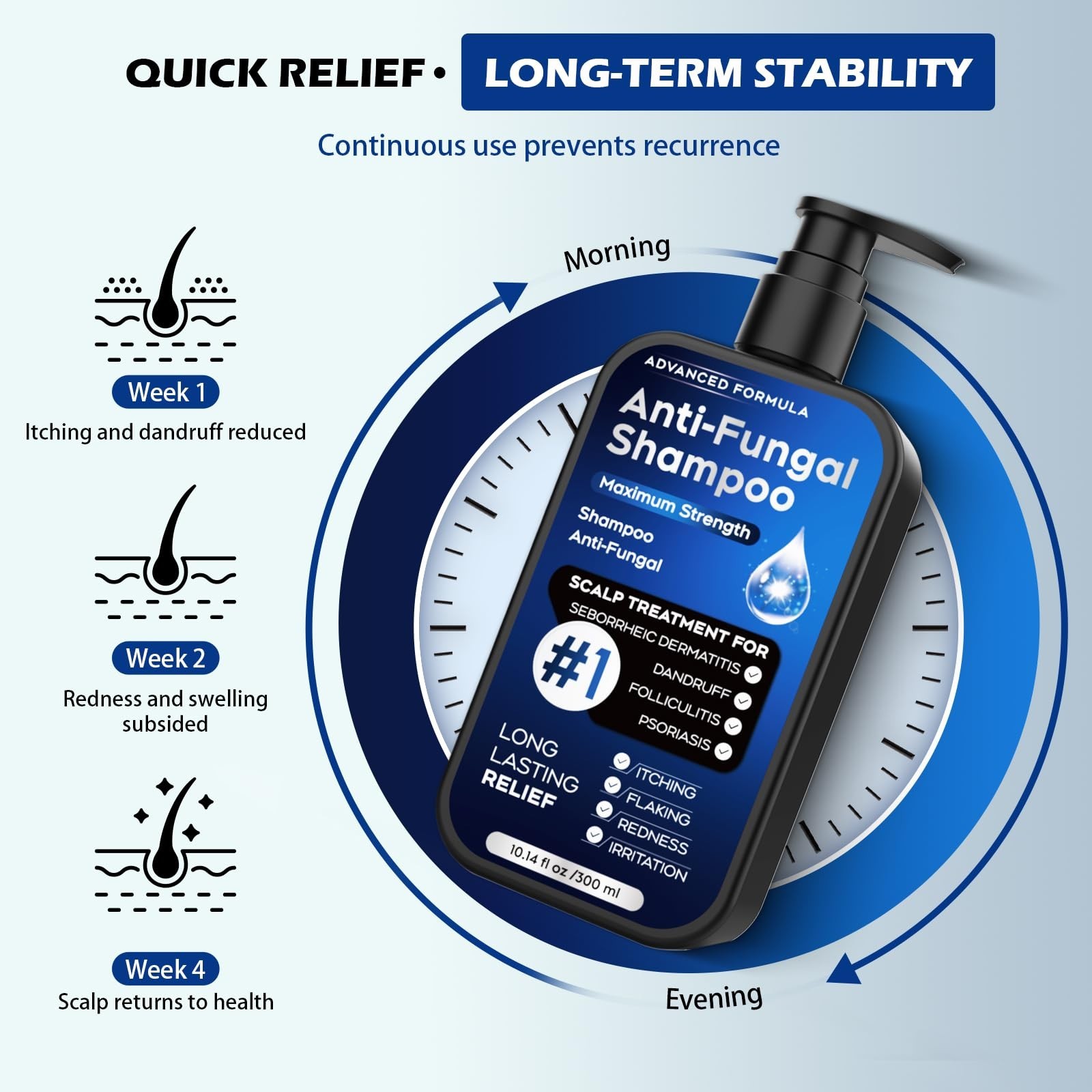 Antifungal Shampoo for Scalp Psoriasis, Dandruff & Itchy Scalp Relief – 10.1 Fl