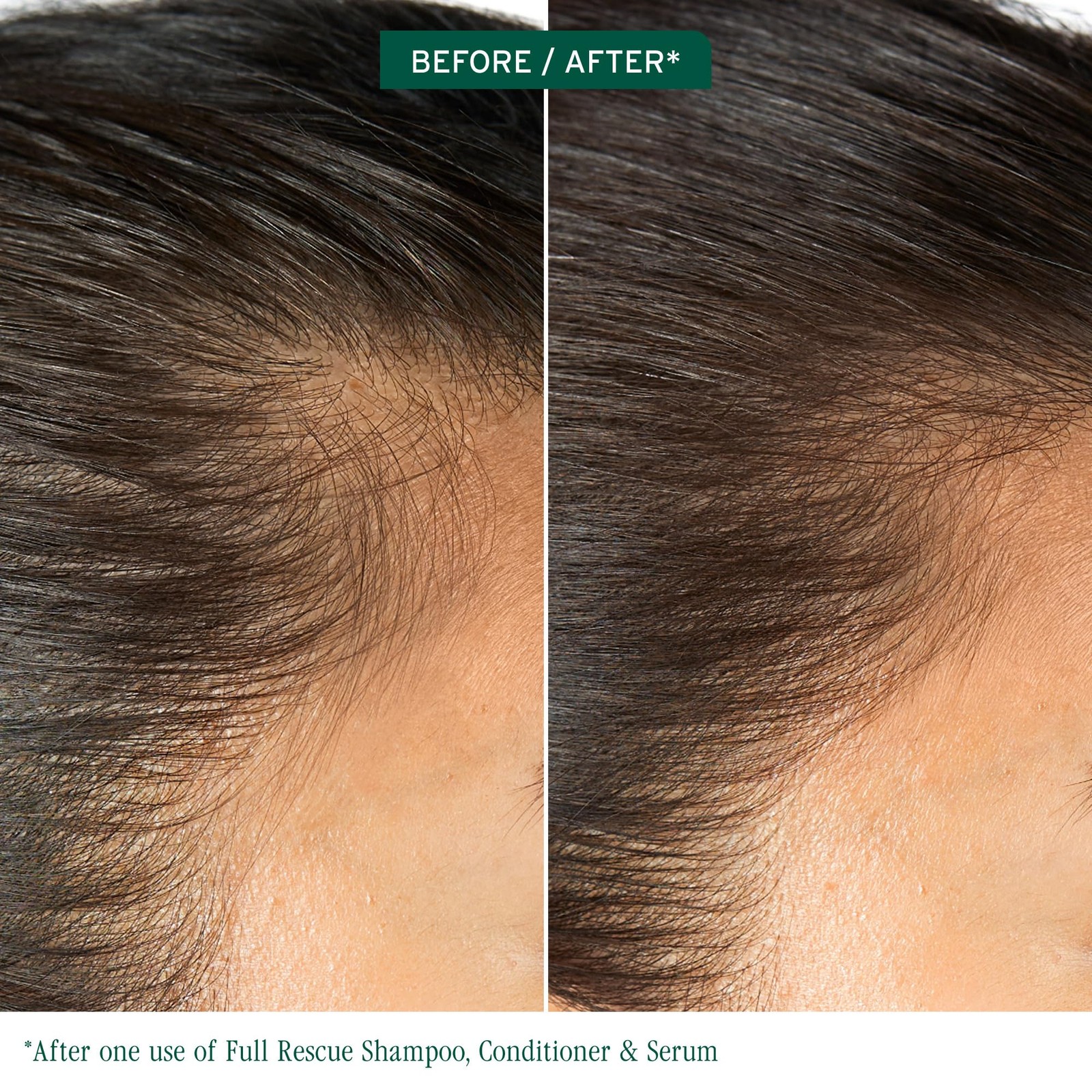 Full Rescue Conditioner – For Fine & Thinning Hair, 7.9 fl oz