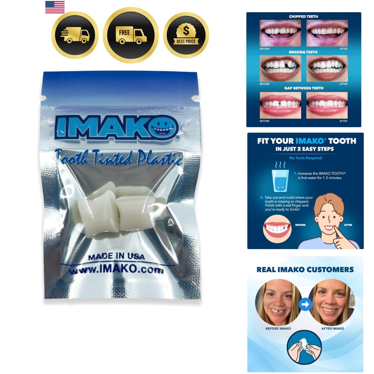 Tooth Tinted Plastic Temporary Tooth Fill Kit for Chipped Gaps Natural Color