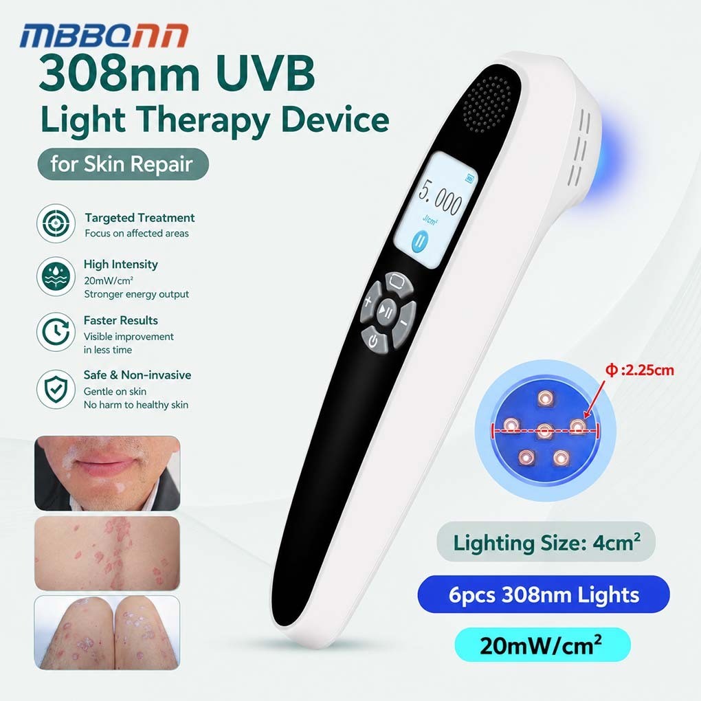 Handheld 308nm UVB Light Therapy Device for Targeted Skin Care, Even Complexion