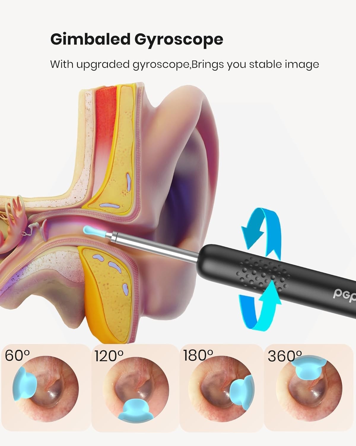 Ear Canal Cleaner with Wi-Fi & 3-in-1 Camera for Ear/Nose/Throat – Black