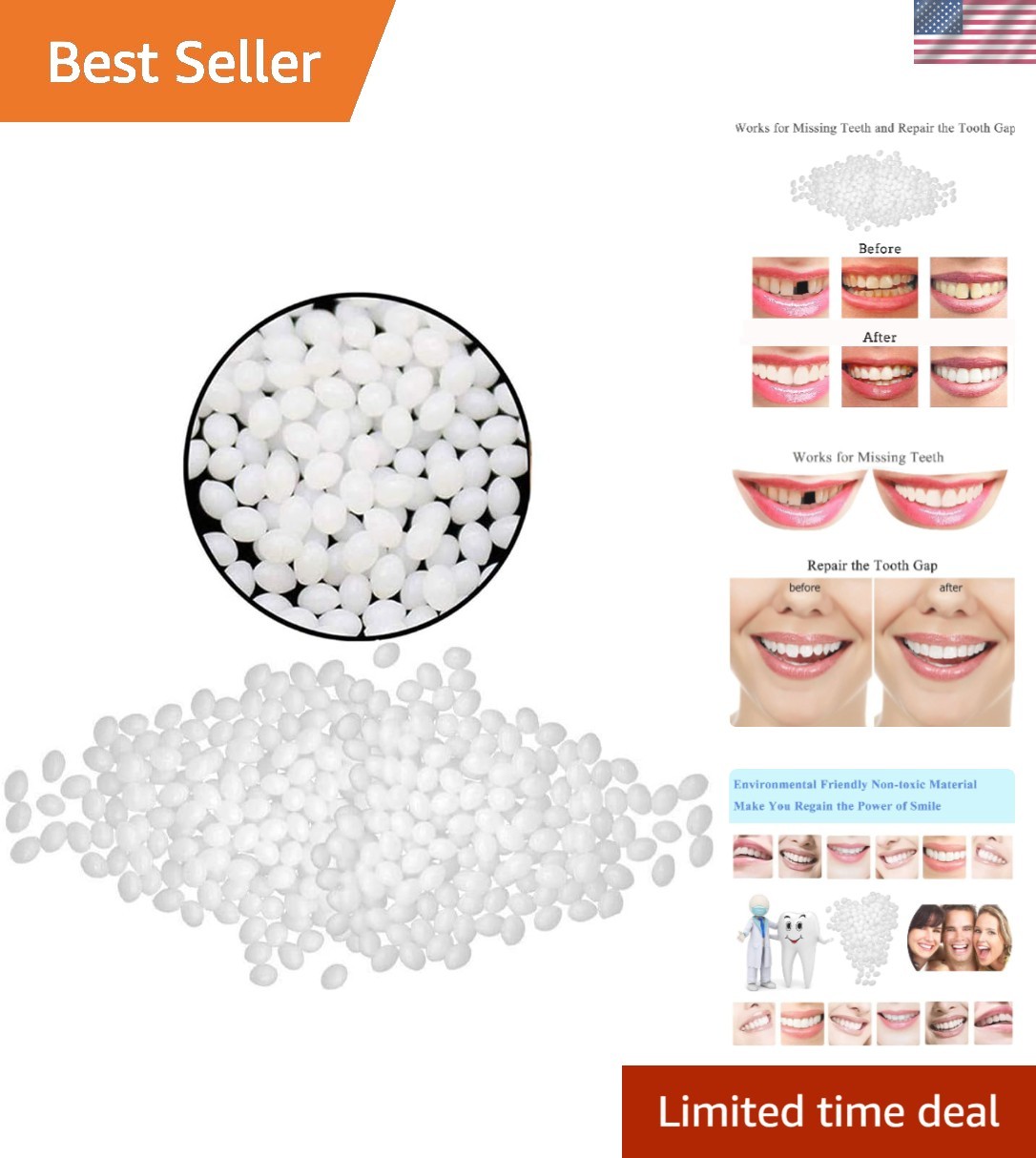 Instant Tooth Repair Kit with Thermal Beads – Restore Your Smile Effortlessly