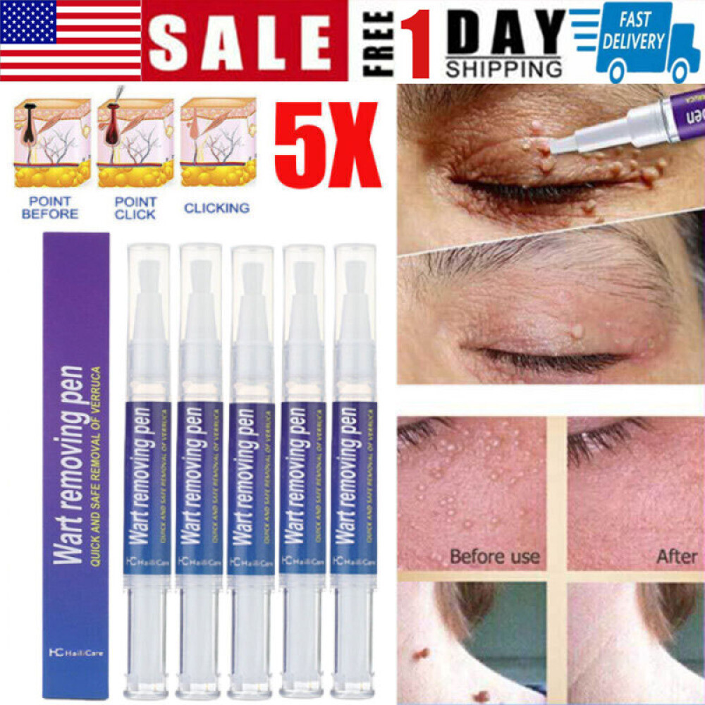5Pack 12 Hours Wart Remover Pen Skin Tag Mole Remover Eliminate Foot Corn Warts