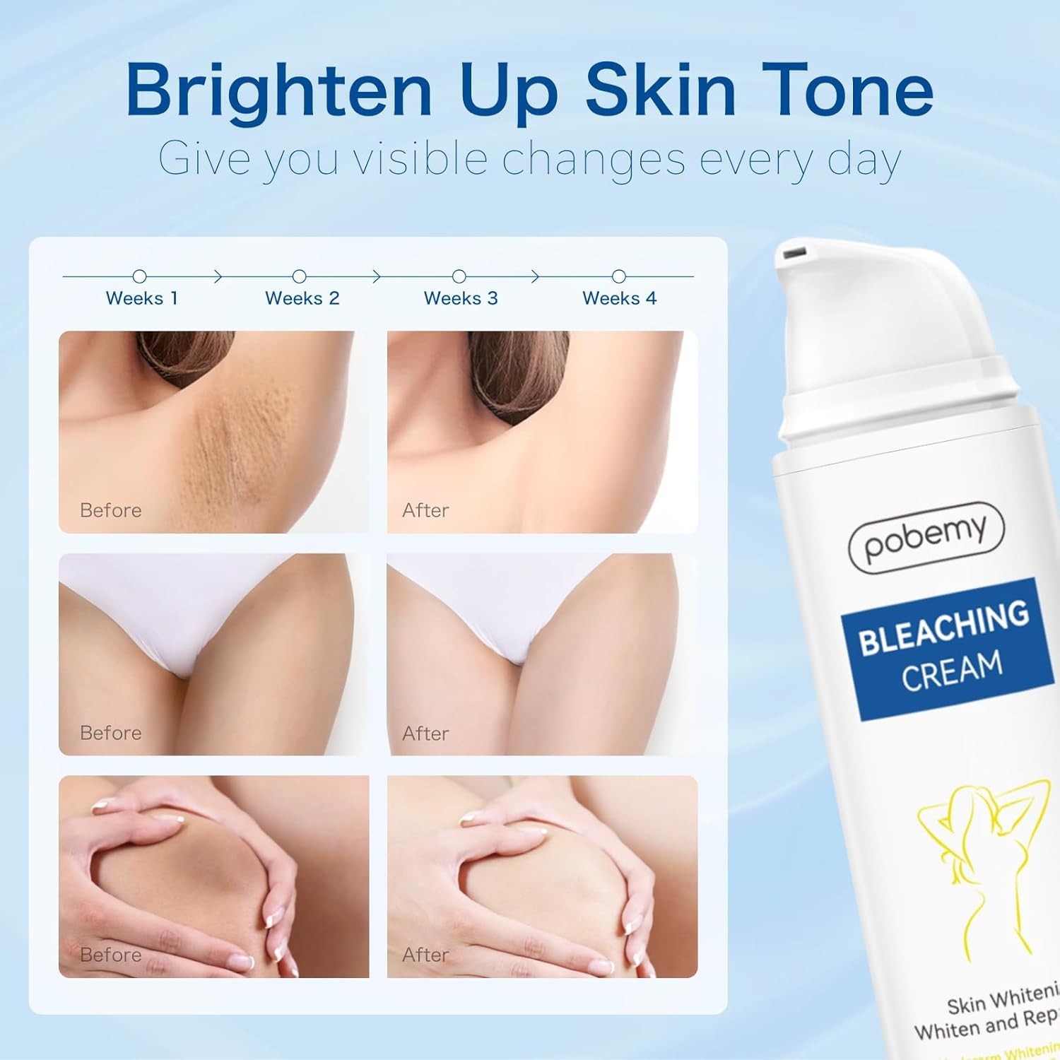 Skin Bleaching Cream, Dark Spot Remover for Face, Intimate Areas & Body