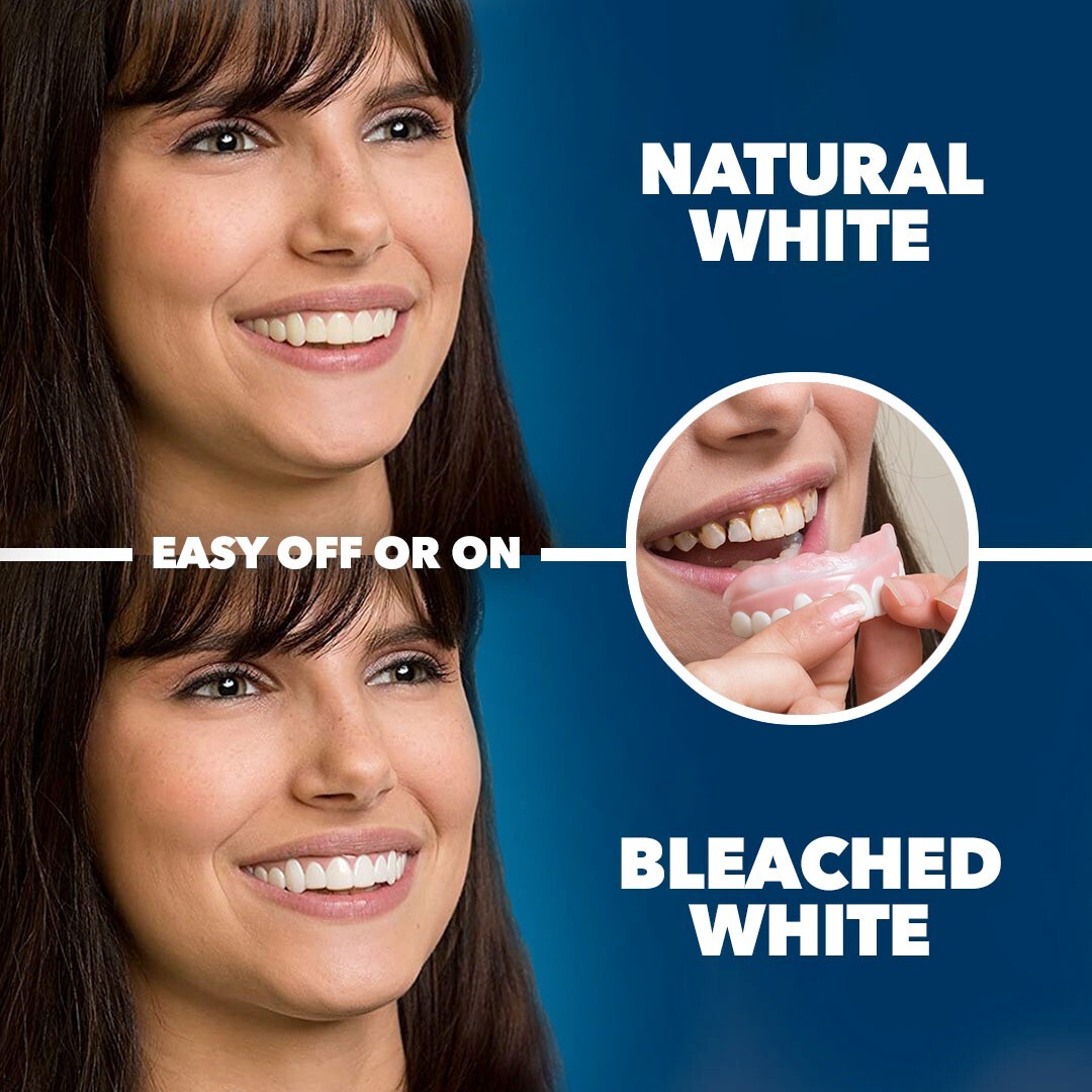 Imako® Temporary Teeth Kit – Small Size Bleached Color