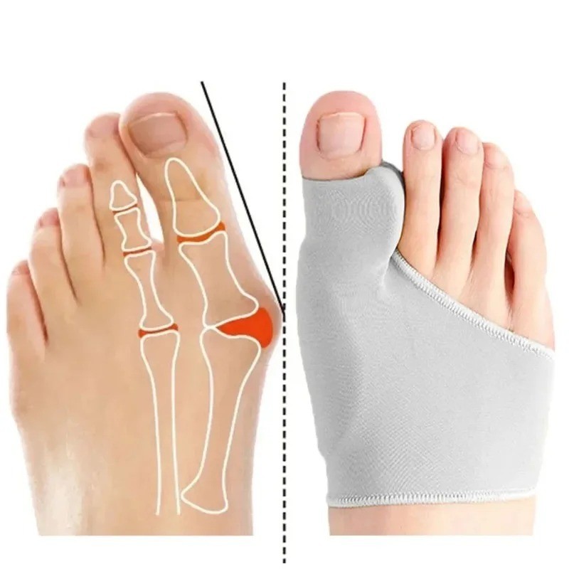 2Pcs Toe Separator Hallux Valgus Bunion Corrector Orthotics Feet Bone Thumb