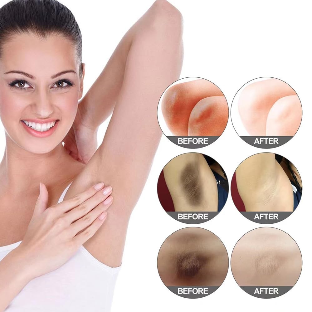 Crema Blanqueadora Natural con Vitamina C para Axilas y Áreas Íntimas
