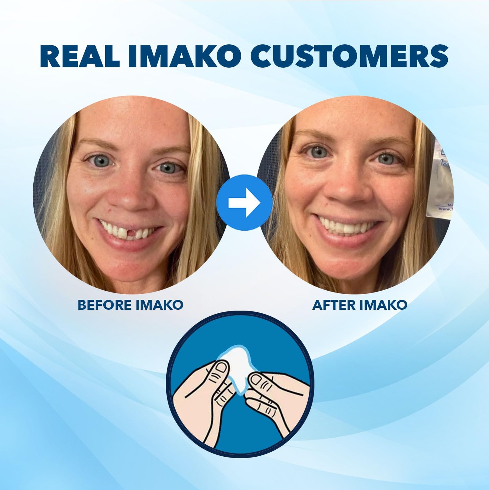 Imako Tooth Tinted Plastic – Natural Color – Temporary Tooth – Made in USA