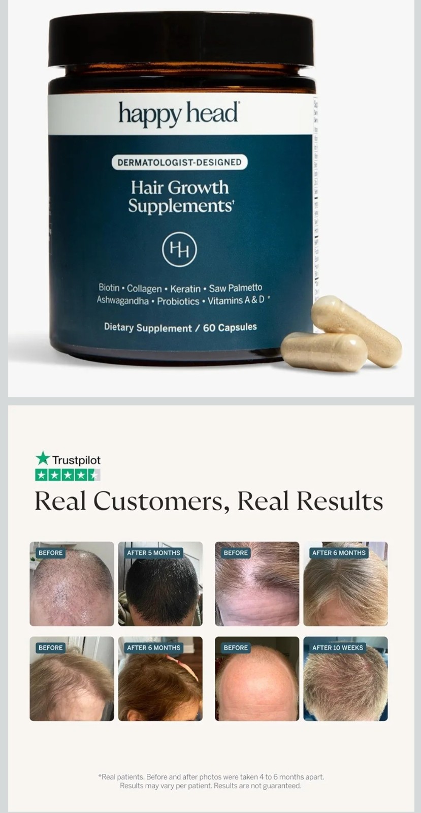 Happy Head Hair Growth Supplement Biotin + Vitamins 60 Capsules Exp 08/2027
