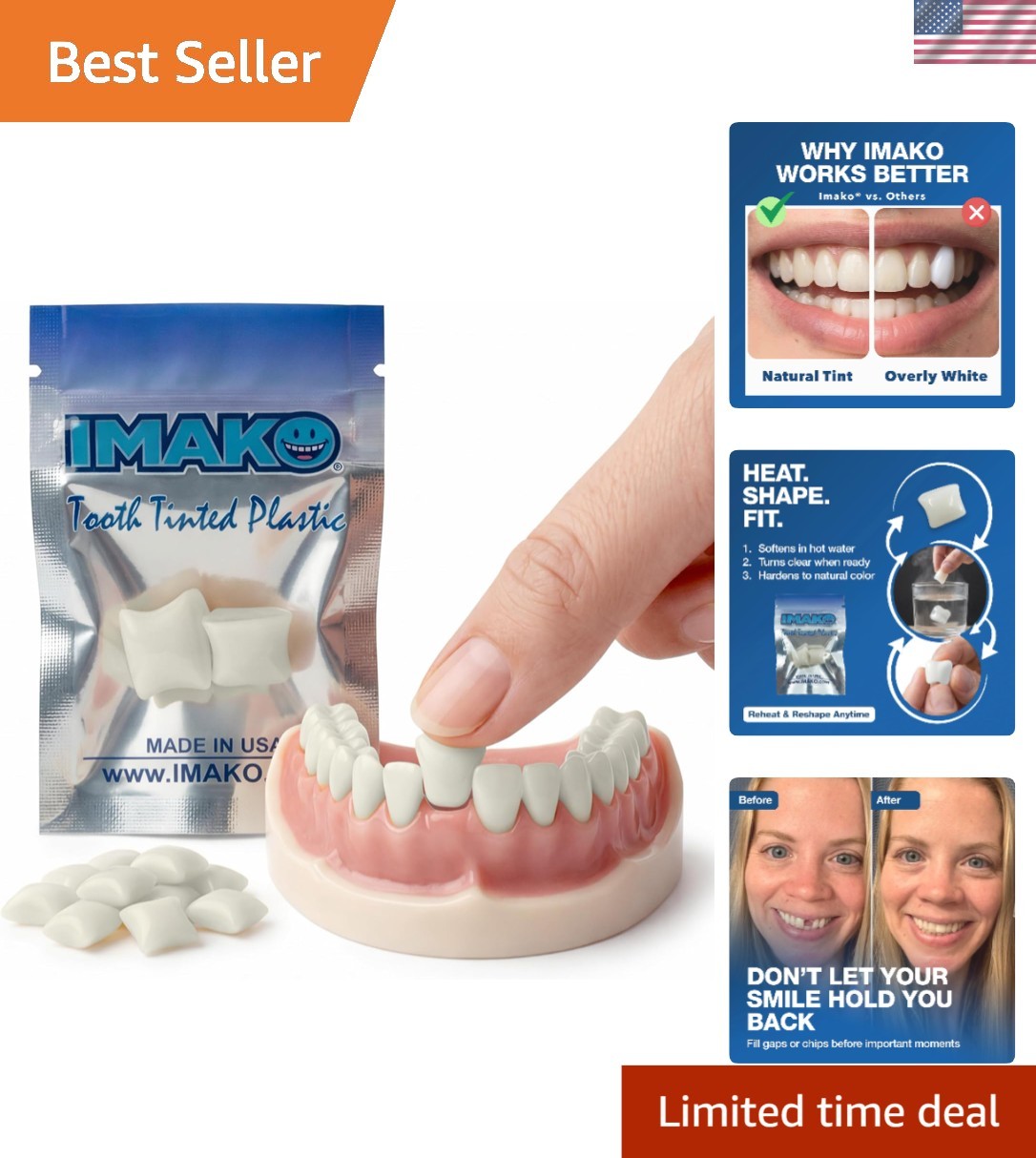 Temporary Moldable Tooth Kit for Adults – Discreet Cosmetic Solution