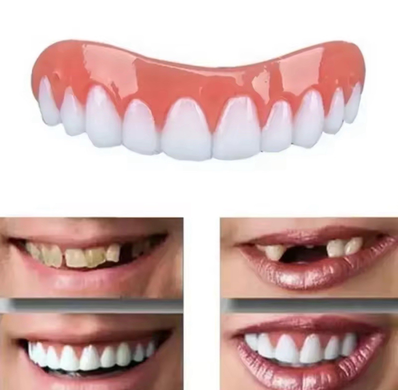 Instant Smile Snap On Veneers Upper Lower Teeth Covers Kit