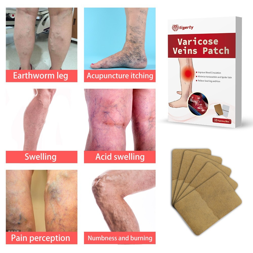 10pc Legs Spider Vein Circulatory Support Varicose Vein Patch Vein Treatment Pad