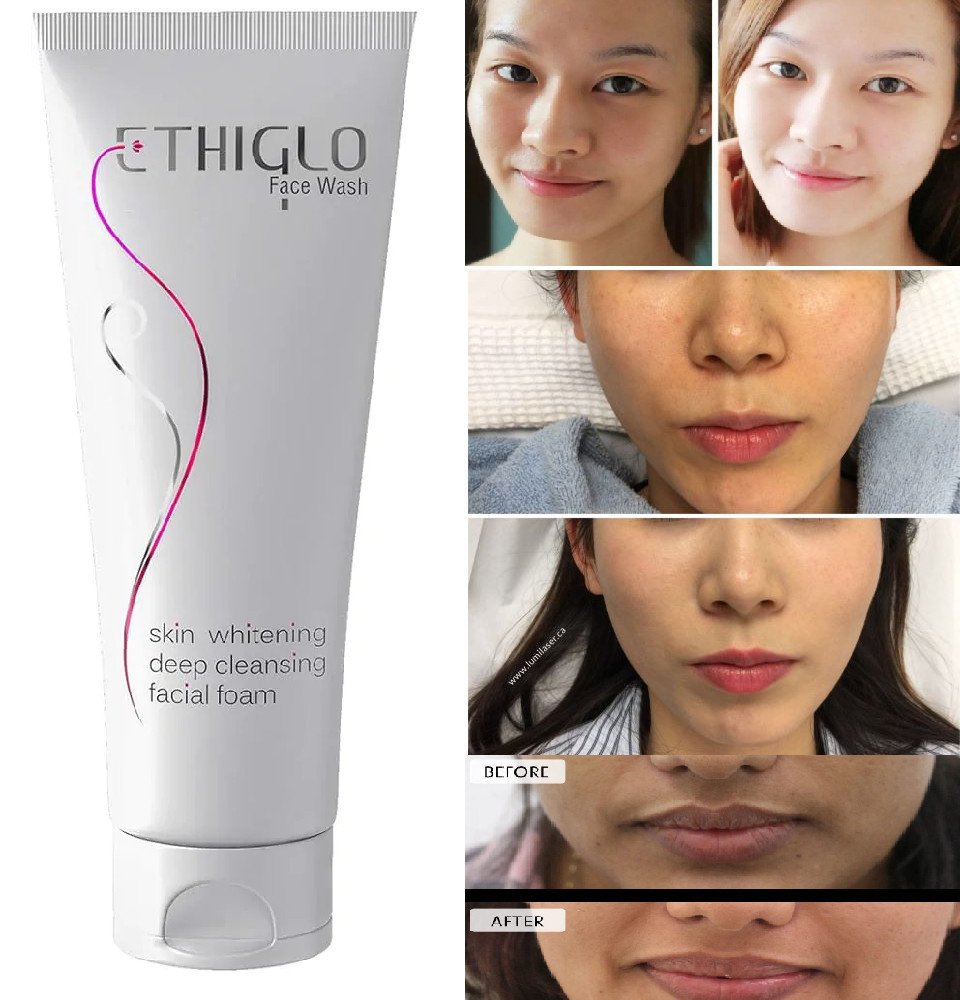 Ethiglo Skin Whitening and Anti Aging Face Wash For Glowing Skin 70ml deep clean