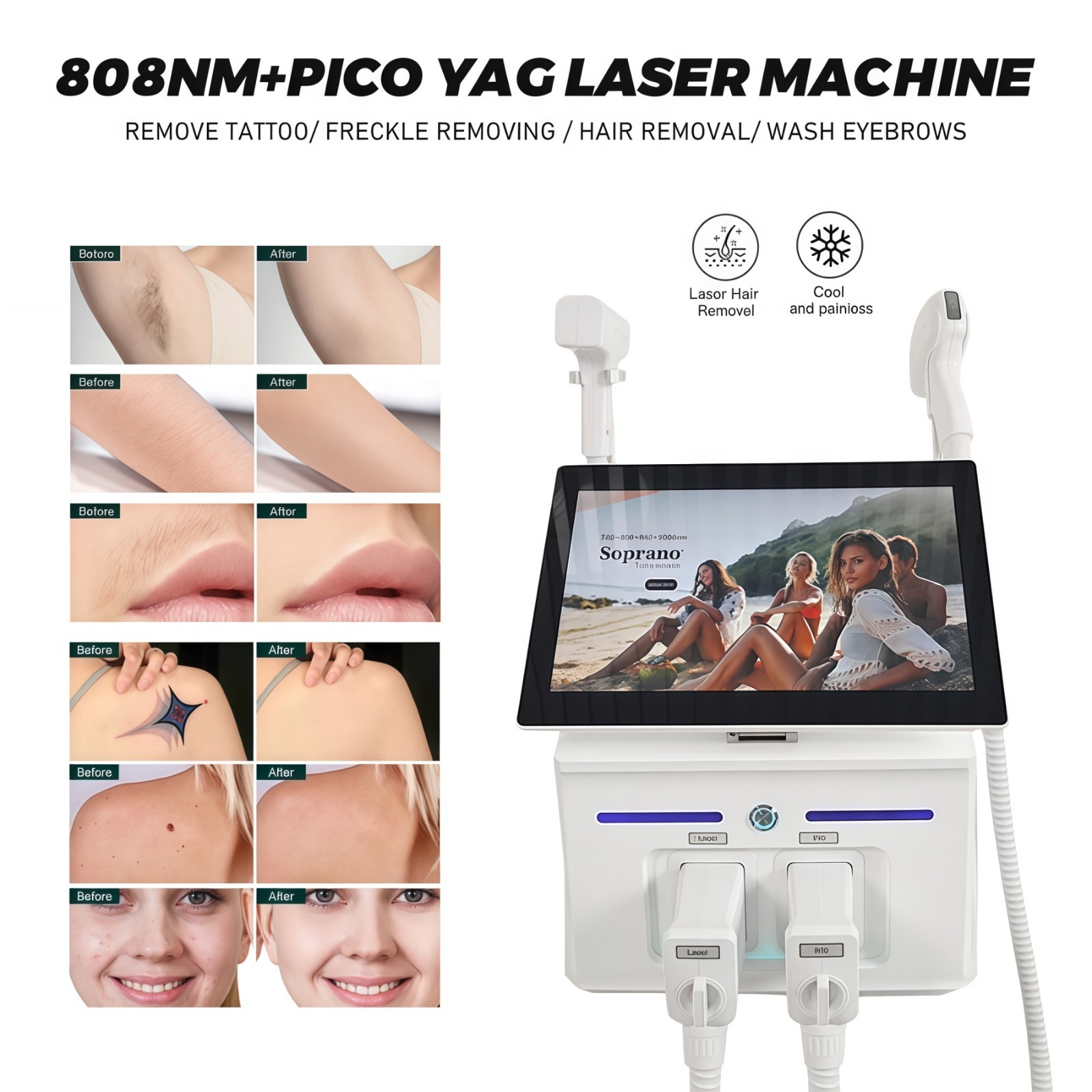 2 IN 1 808nm Diode Laser Hair Removal & Picosecond Laser Tattoo Removal Machine
