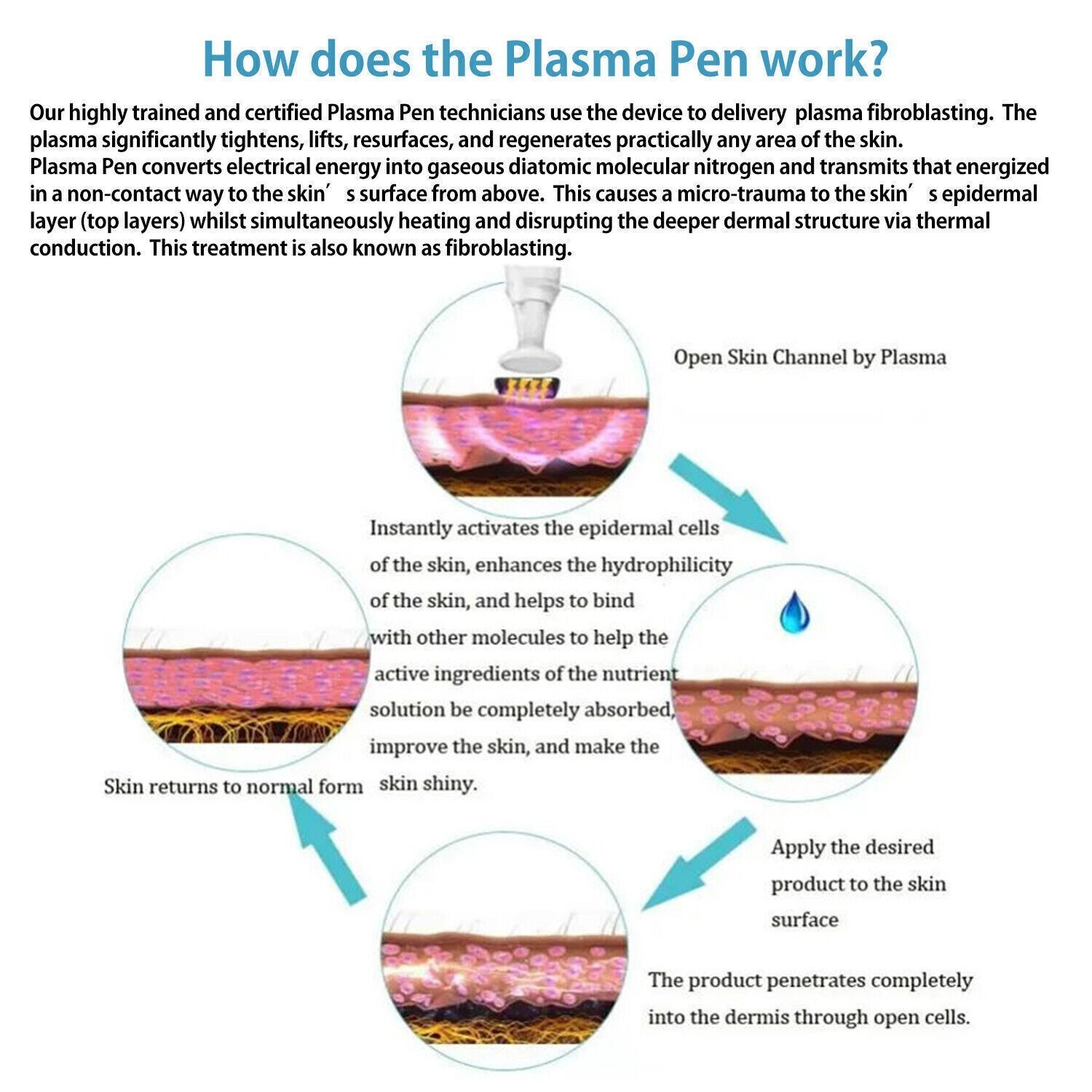 Plasma Lift Pen Machine Cold Ozone Acne Treatment Skin Care Beauty Device