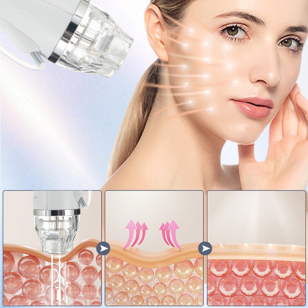 2in1 RF Micro-n-eedle Machine Cold Hammer Anti Scars Spot Wrinkle Removal Beauty