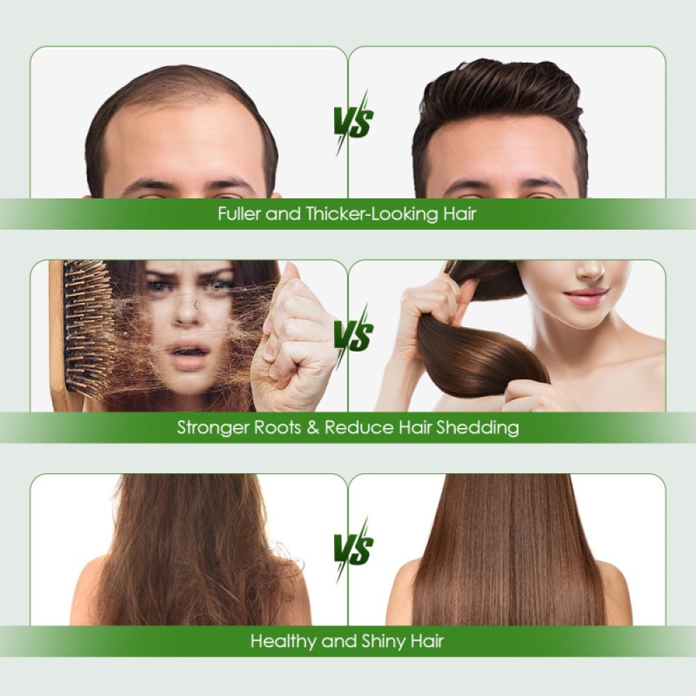 Micro Infuse Hair Regrowth System, Advanced Hair Growth Serum Treatment Ginseng