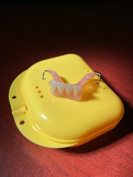 CUSTOM MISSING TEETH FLIPPER/ StayPlate for Upper Lower (Hard Acrylic MATERIAL)
