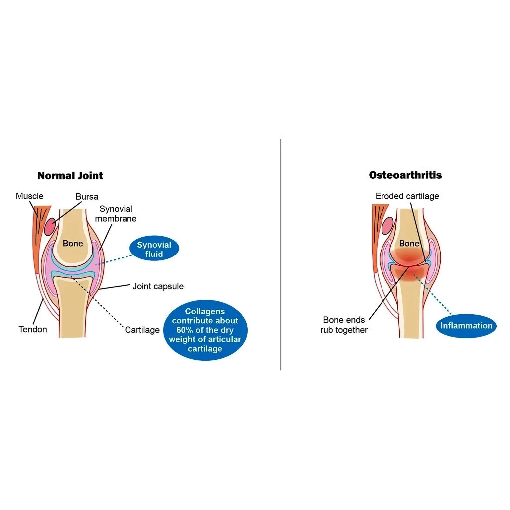 Mobithron Advance Joint Support Knee Joint Pain Waist & Back Flexibility 30 Caps