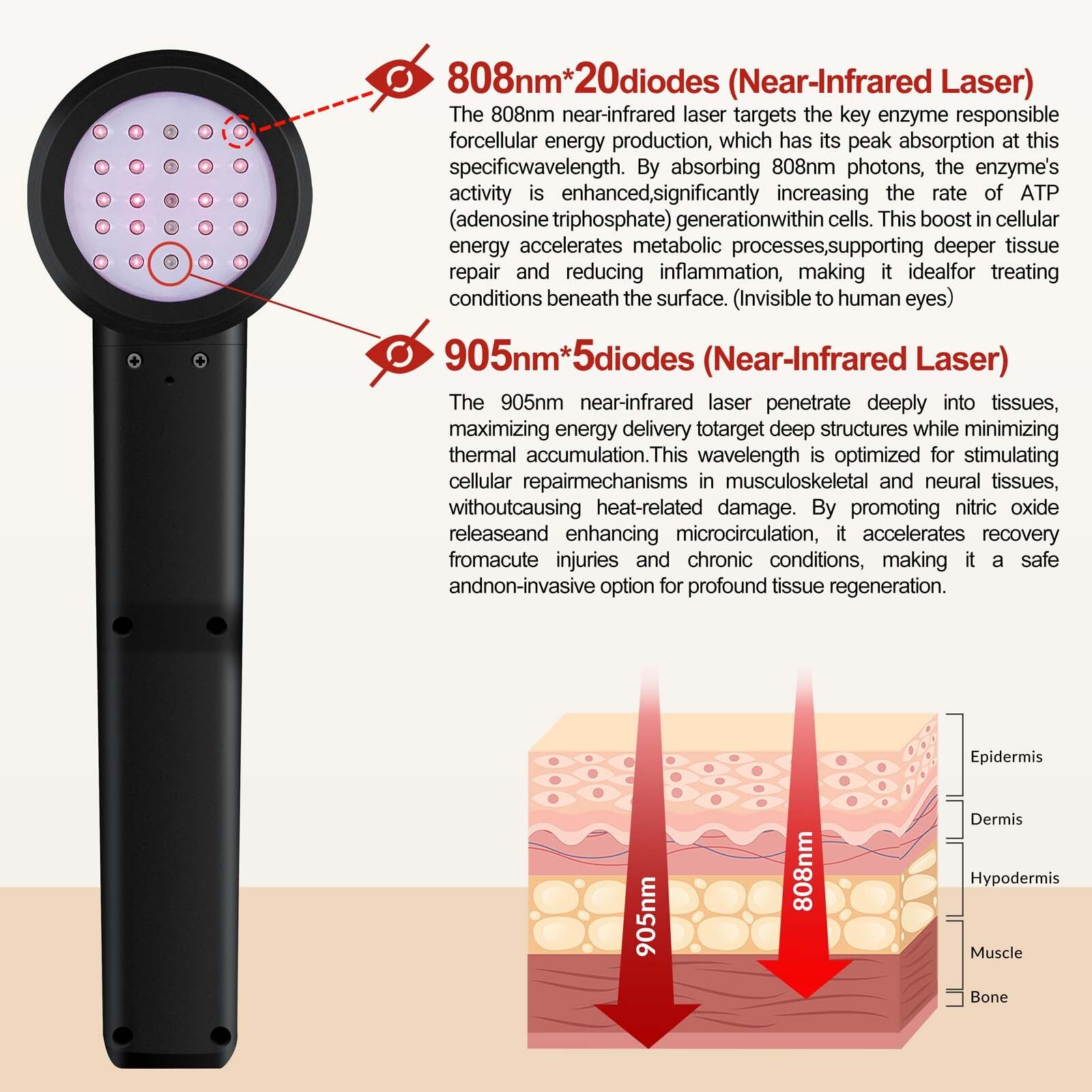 Deep Tissue Cold Laser Device 808nm 905nm Red Light for Arm Elbow Sprain Relief