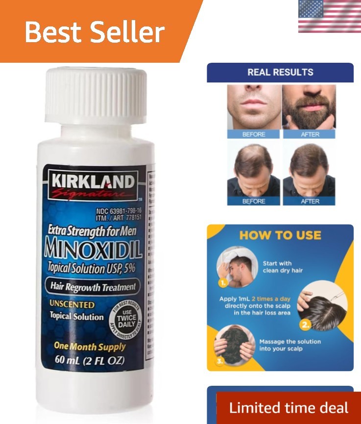 Signature 5% Minoxidil for Men – 2 Ounce Hair Regrowth Solution, 1 Supply
