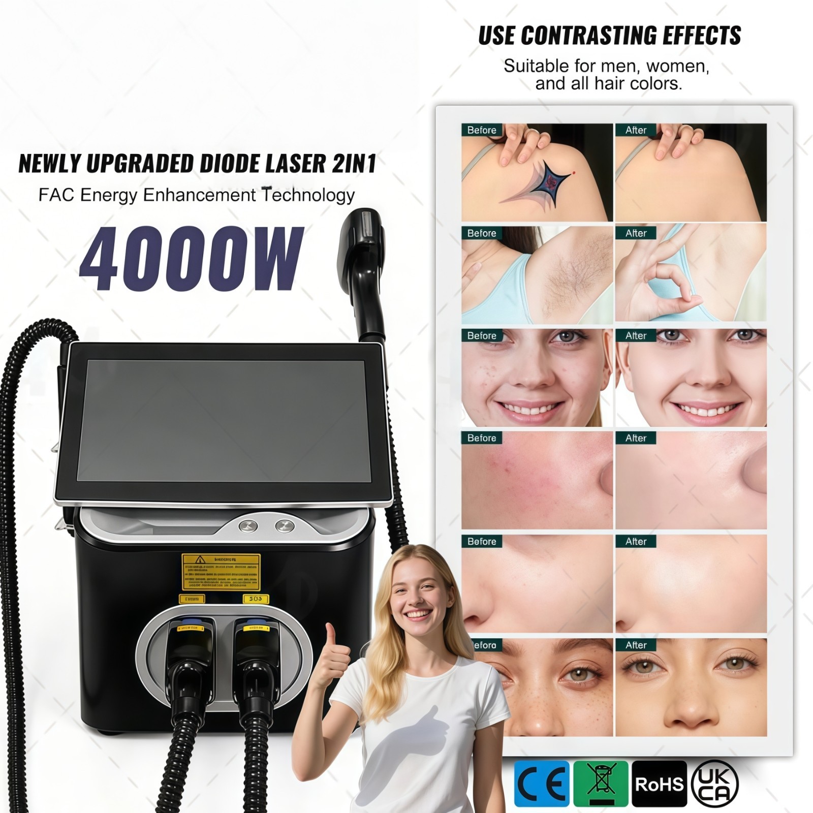 2 in 1 755/808/940/1064nm Diode Laser Hair Removal Pico Tattoo Removal Machine