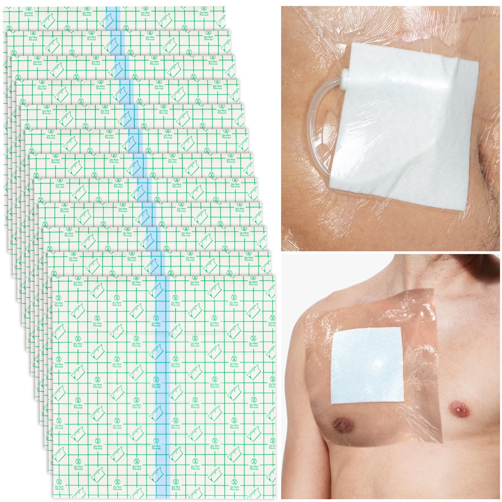 Large Waterproof Dressing for Wounds, Hemodialysis Peritoneal Dialysis Catheter