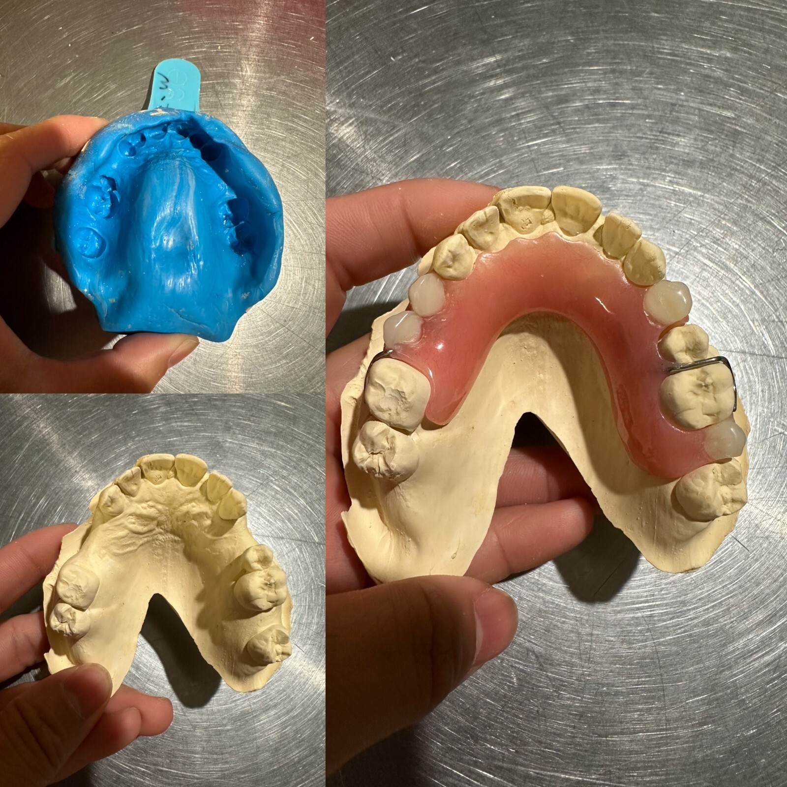 CUSTOM MISSING TEETH FLIPPER/ StayPlate for Upper Lower (Hard Acrylic MATERIAL)