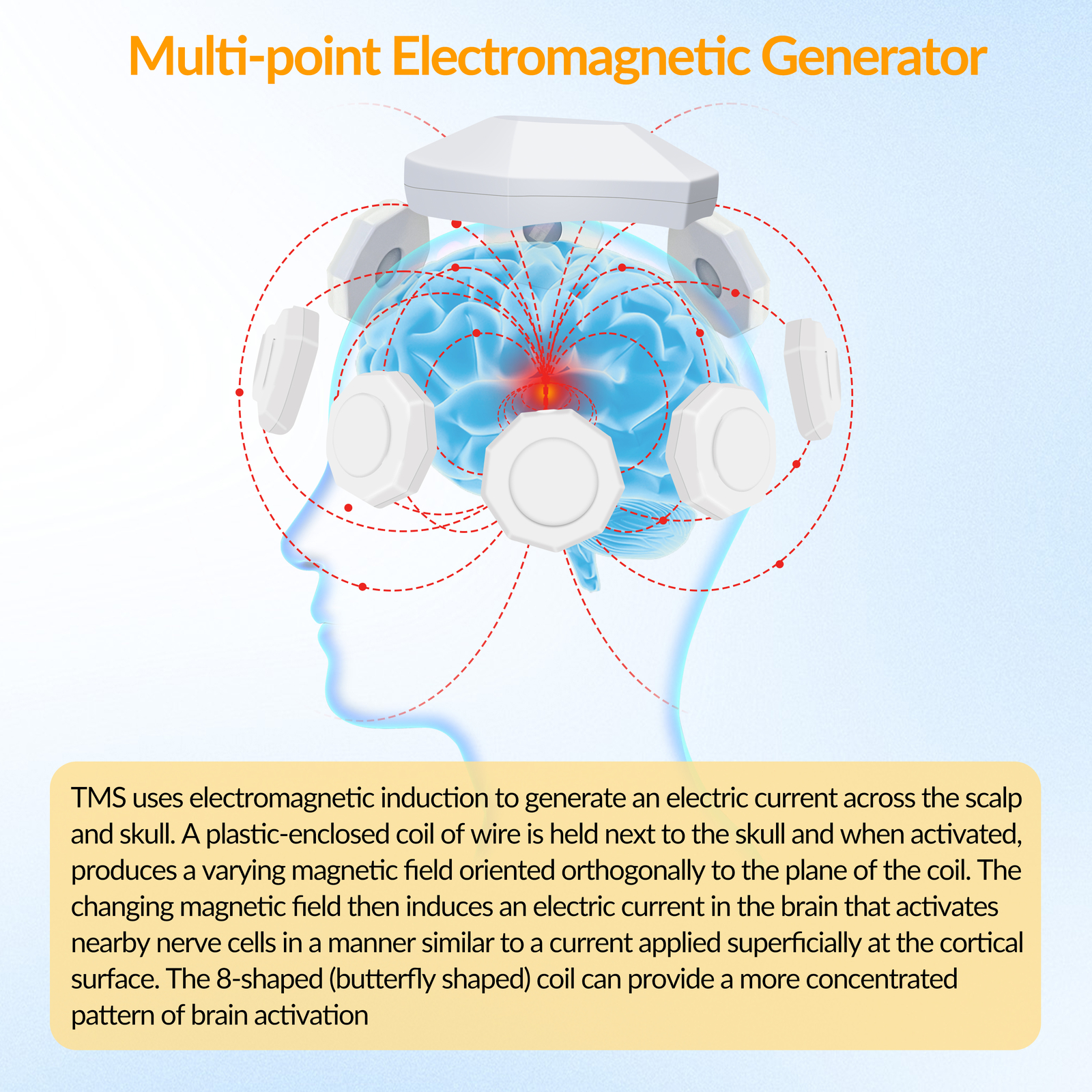 Transcranial Magnetic Stimulation Tms for Ocd Accelerate Intracranial Blood Flow