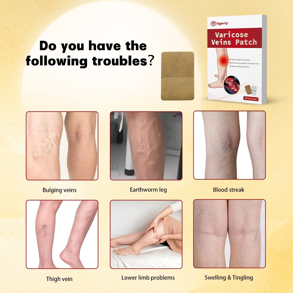10pc Legs Spider Vein Circulatory Support Varicose Vein Patch Vein Treatment Pad